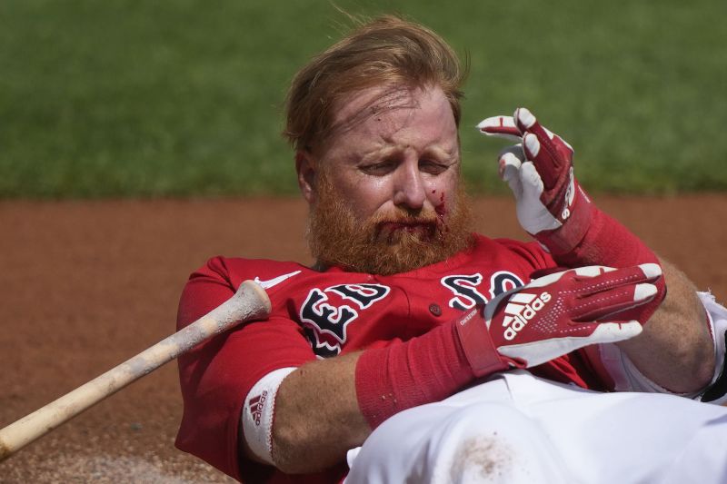 Justin Turner Boston Red Sox third baseman receives 16 stitches after taking pitch to the face CNN