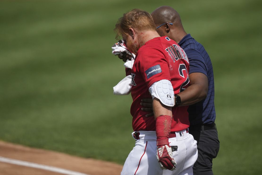 Turner is helped off the field after being hit in the face by a pitch.