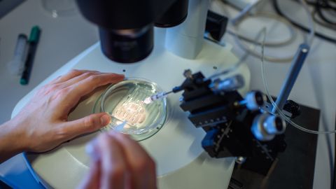 A researcher handles a petri dish while observing a CRISPR/Cas9 process through a stereomicroscope at the Max-Delbrueck-Centre for Molecular Medicine in 2018.