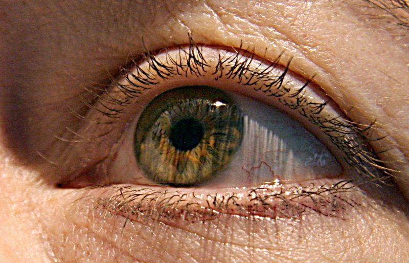 Alzheimer s first signs may appear in your eyes study finds CNN