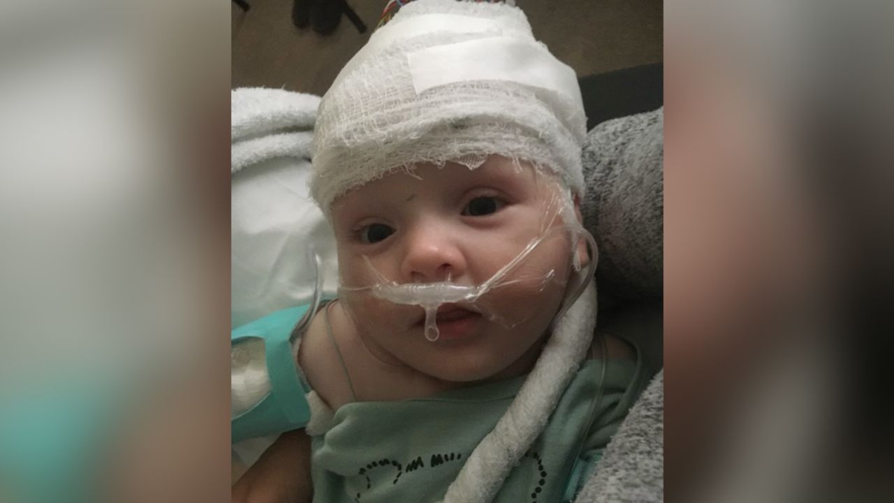Henry Saladino is shown when he was 9 months old and increasingly exhibiting symptoms of AHC.
