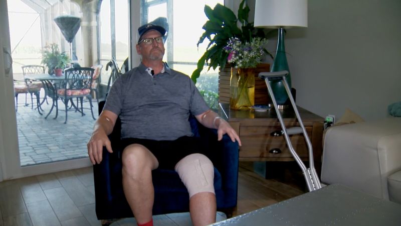 A Florida man heard a bump at his door. It was an alligator — and it bit his leg | CNN
