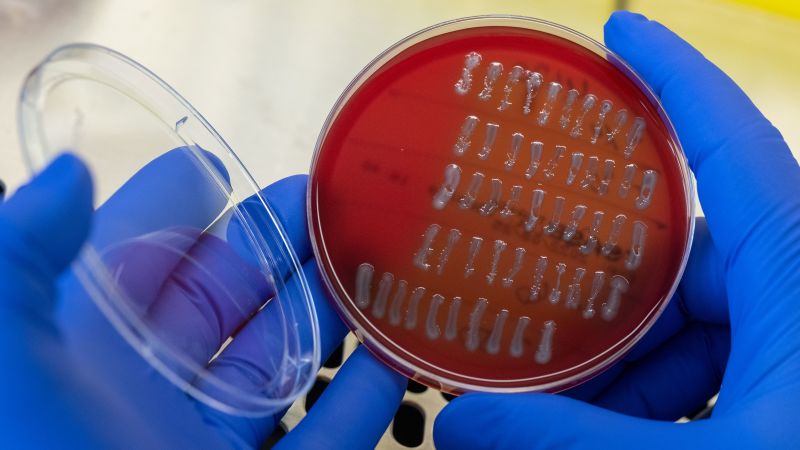 Foodborne bacteria could be causing more than half a million UTIs in the US every year, study finds