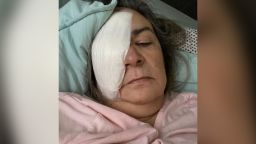Clara Oliva had her right eye surgically removed after using EzriCare artificial tears.