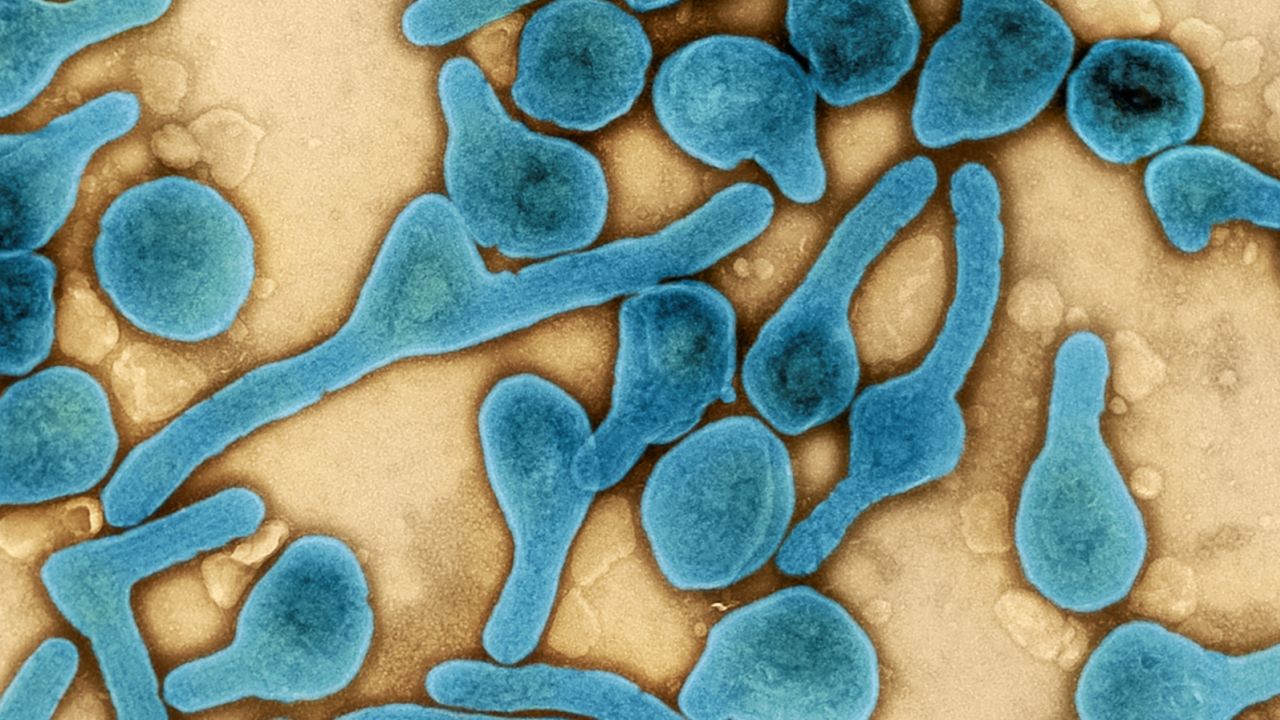 A color-enhanced electron micrograph depicts particles of Marburg virus, which, like the Ebola virus, is part of the filovirus family. 