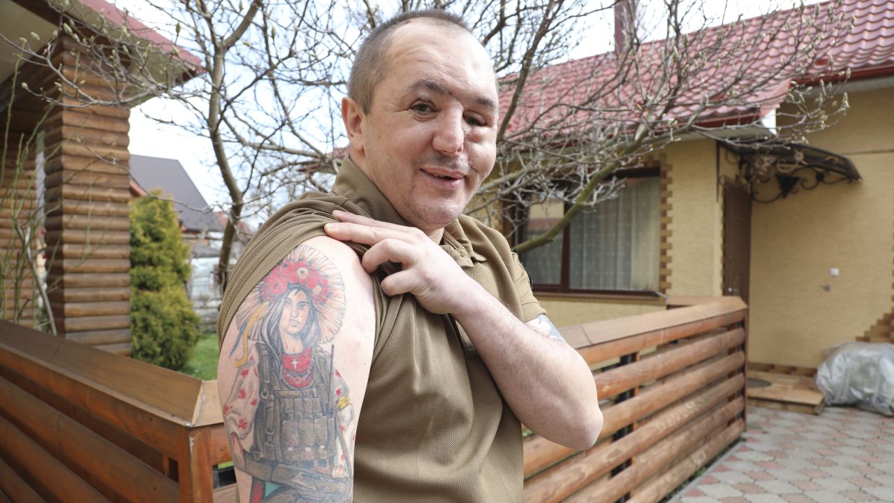 Roman Belinsky proudly displays his wartime tattoos at his home ahead of his third facial reconstruction surgery. "This is Lesya Ukrainka [a renowned Ukrainian poet], my mother with machine gun." 