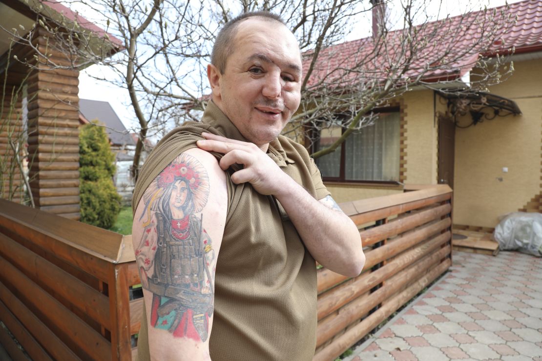 Roman Belinsky proudly displays his wartime tattoos at his home ahead of his third facial reconstruction surgery. "This is Lesya Ukrainka [a renowned Ukrainian poet], my mother with machine gun." 