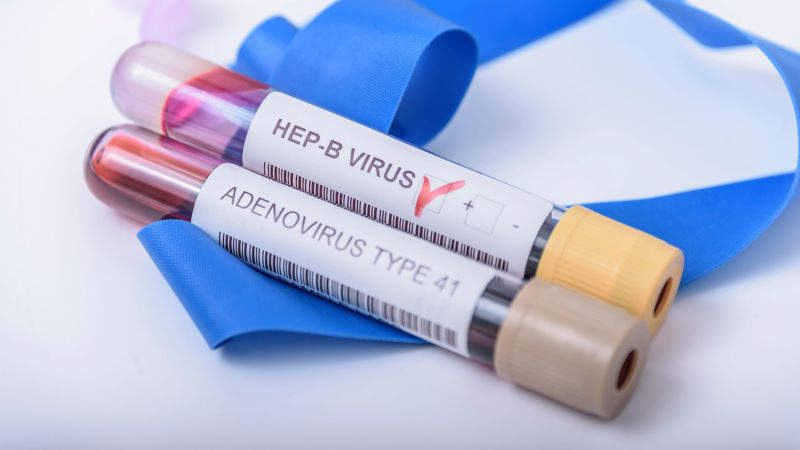 Mysterious Hepatitis Outbreak In Kids In 2022 Linked To Common   230330140404 Hepatitis Outbreak Adeno Associated Virus 032023 