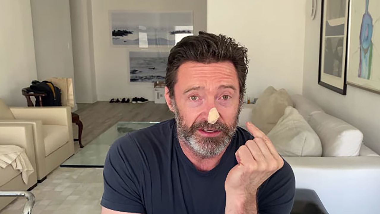 Hugh Jackman recently spoke about his experience of doing a skin biopsy. 