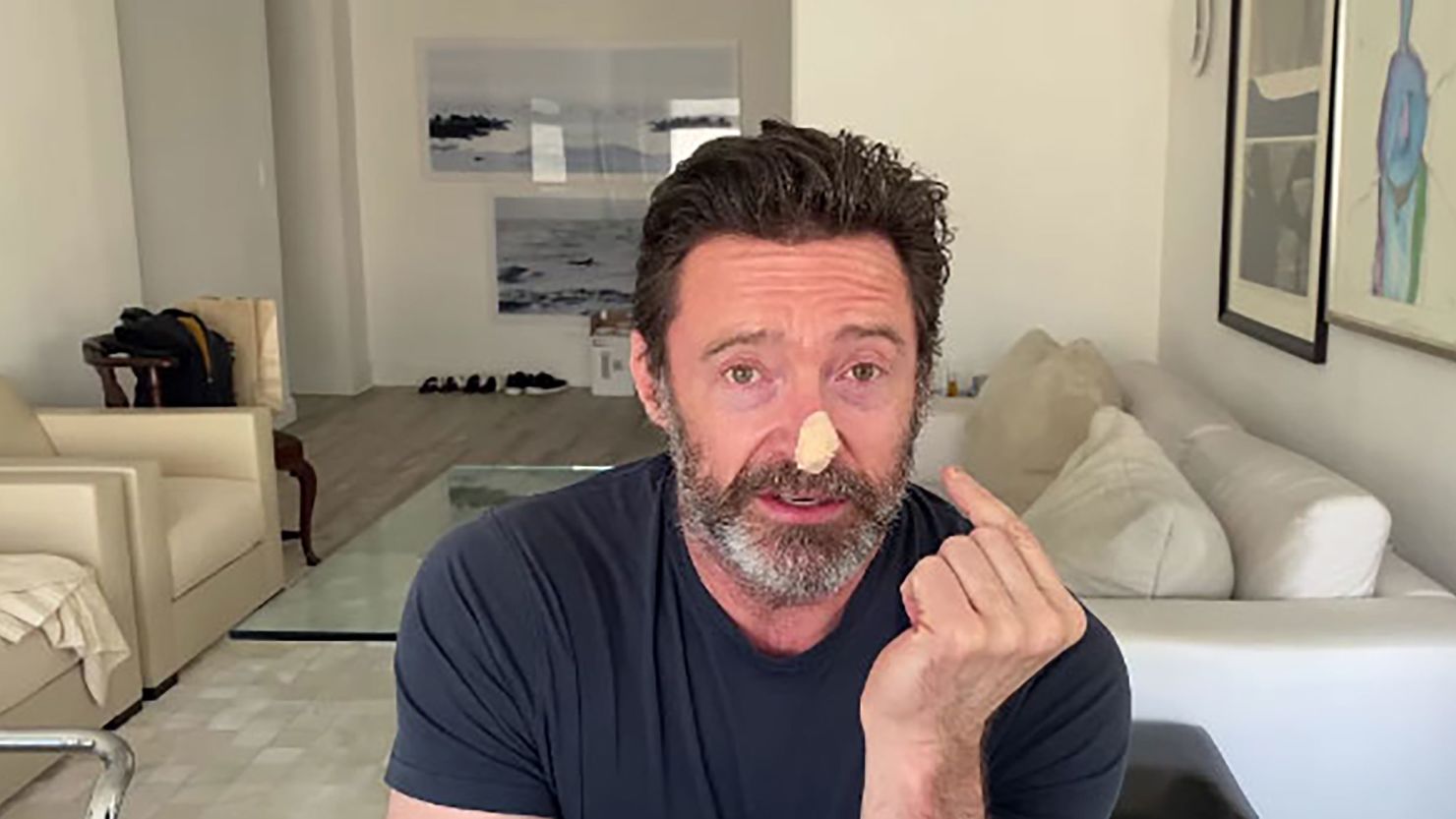 Hugh Jackman spoke about his experience of doing a skin biopsy recently on Instagram. 