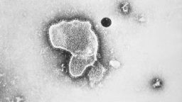 This highly-magnified, 1981 transmission electron microscopic (TEM) image, reveals some of the morphologic traits exhibited by a human respiratory syncytial virus (RSV). The virion is variable in shape, and size, with an average diameter between 120-300nm. RSV is the most common cause of bronchiolitis and pneumonia among infants and children, under 1-year of age.