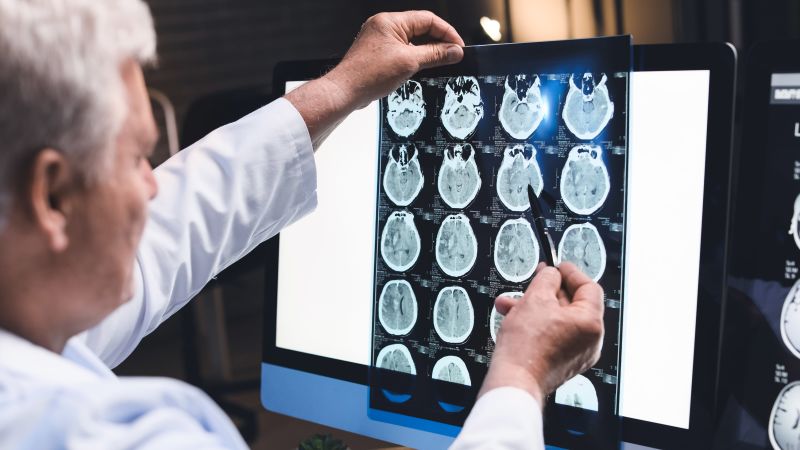 US health officials aim to ‘transform’ Alzheimer’s research with $300 million data platform