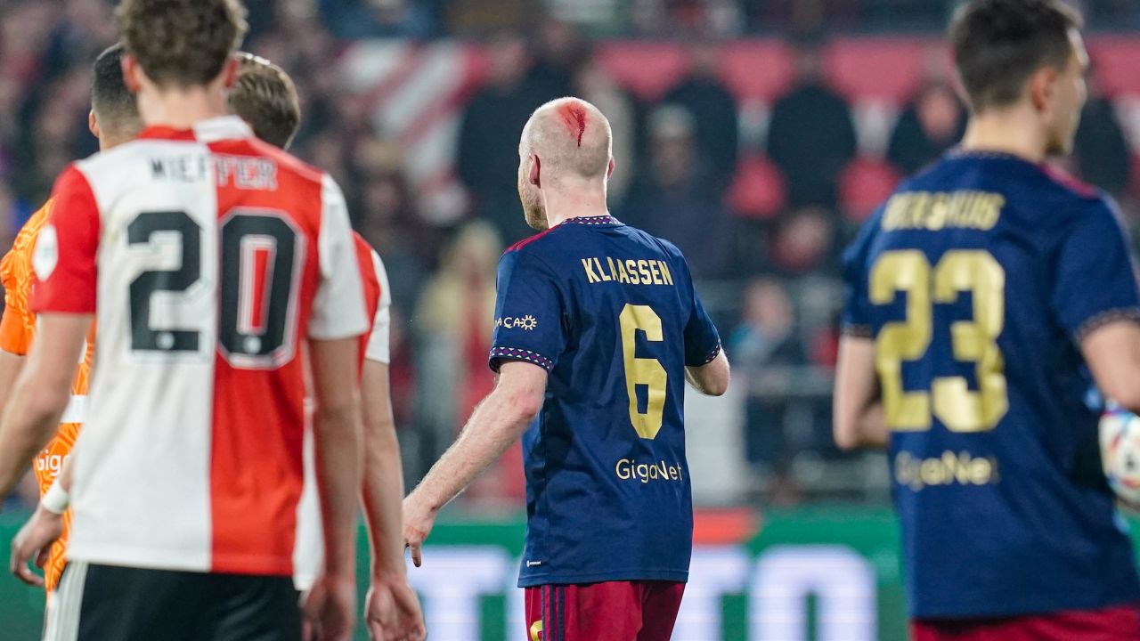 Ajax player Davy Klaassen with blood on his head after being struck by an object thrown from the stands. 