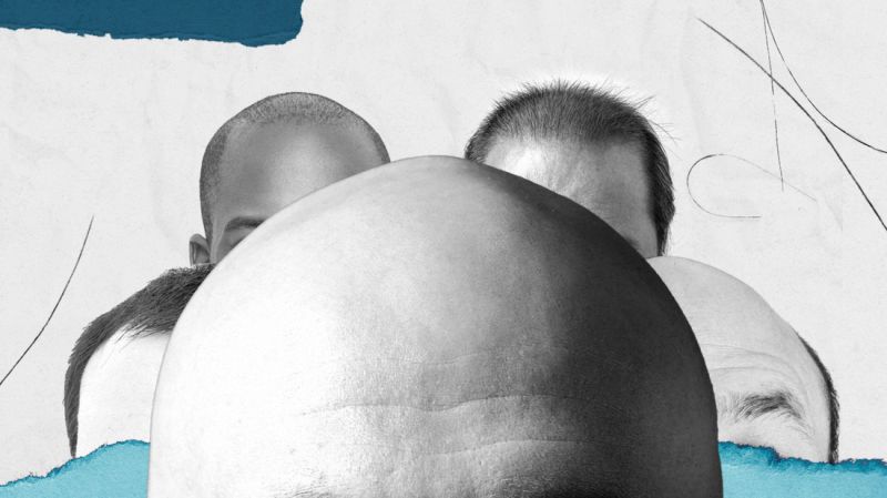 Male pattern baldness and the art of growing bald gracefully