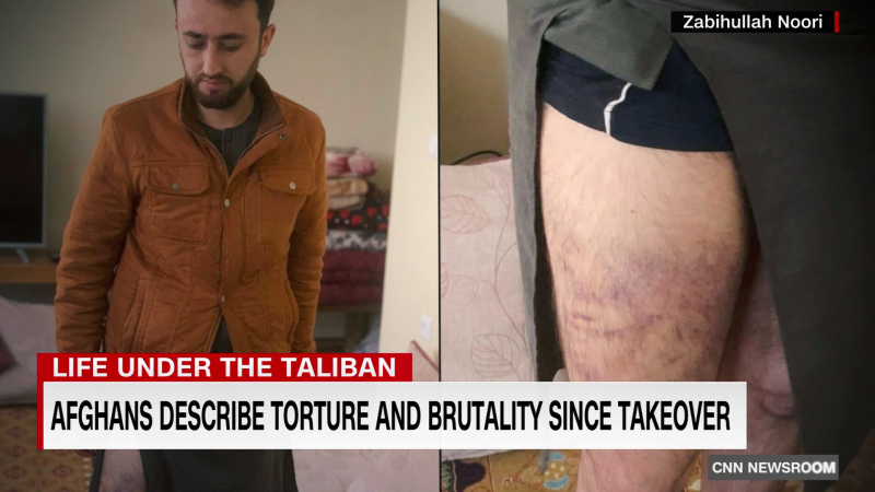 Afghans Describe Torture And Brutality Since Taliban Takeover | CNN