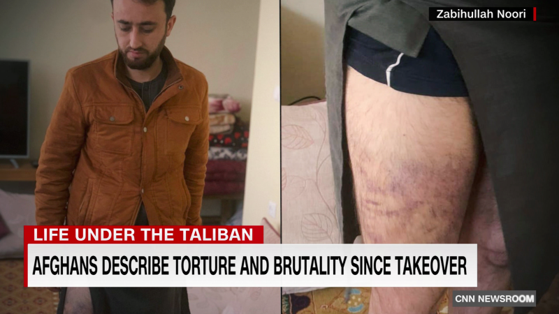 Afghans describe torture and brutality since Taliban takeover | CNN