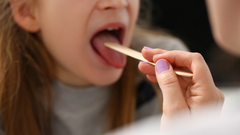NextImg:Strep infections in the US surged this winter, up nearly 30% from pre-pandemic peak | CNN