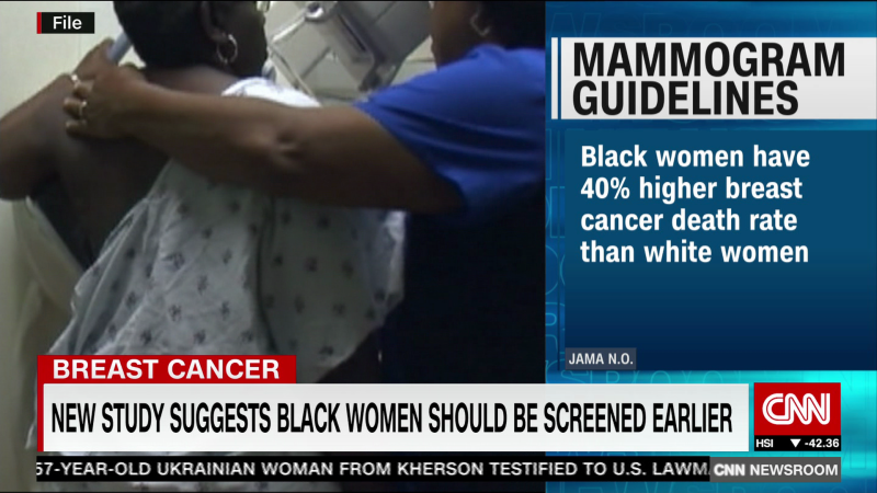 New study suggests Black women should be screened at younger age for breast cancer | CNN