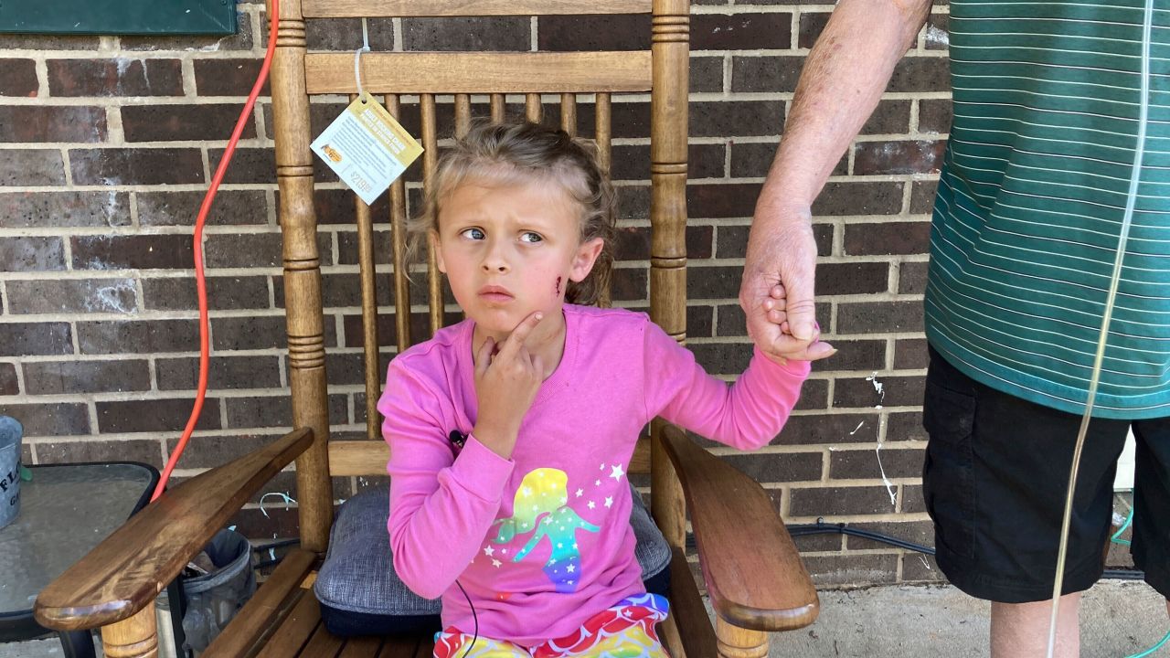 Kinsley White, 6, shows reporters a wound left on her face.