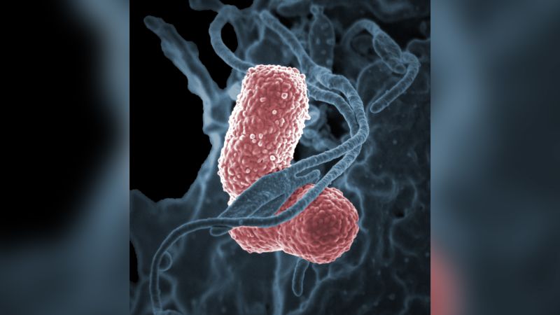 Bacterial Outbreak Causes 31 Infections In A Seattle Hospital CNN   230427170517 Seattle Klebsiella Outbreak 042023 