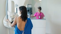 female patient having annual mammograph