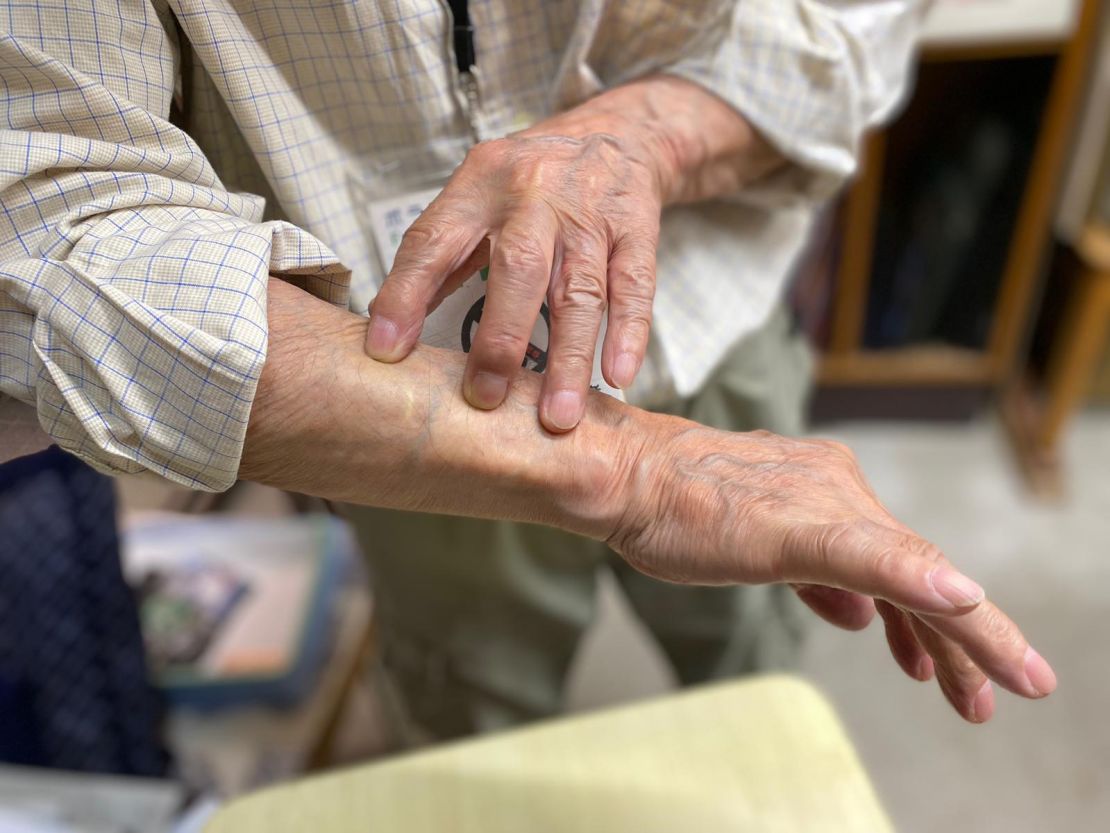 The force of the atomic blast threw Terao, then age 4, off his feet and shattered windows. Glass shards peppered Terao, leaving scars all over his body that are visible to this day.