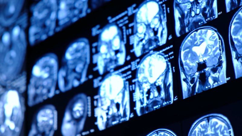 Neuroscientists test out brain-reading AI on CNN reporter | CNN Business