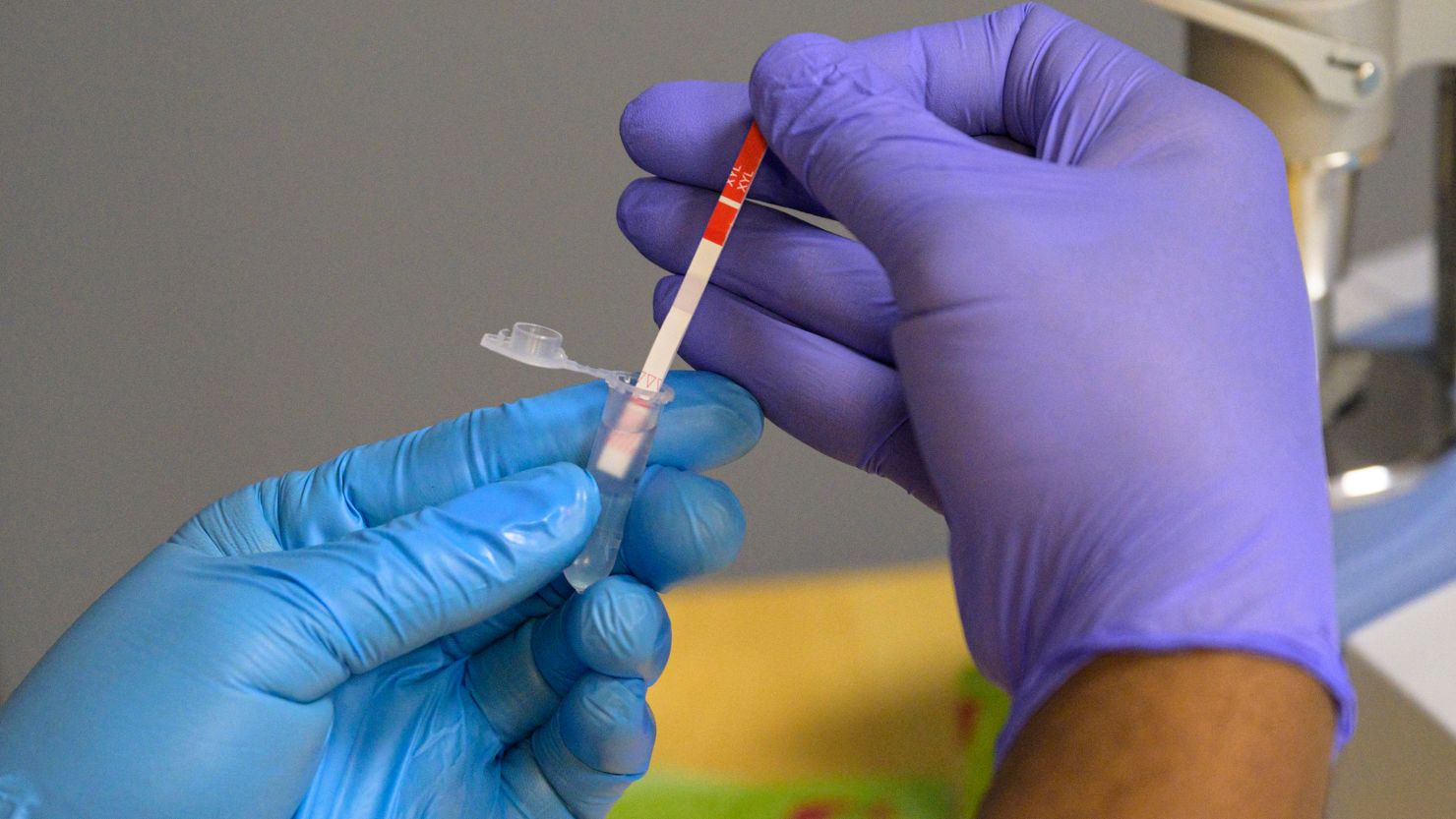 Leonardo Dominguez Gomez, field researcher with the New York City Department of Health, tests a heroin sample for xylazine at St. Ann's Corner of Harm Reduction in New York City on May 25, 2023. The tranquillizer, approved for veterinary use by the US Food and Drug Administration (FDA), has infiltrated the illegal drugs market in the US, with producers increasingly using it to augment fentanyl. Overdose deaths where tranq was detected have soared in recent years and in April the White House designated the drug an "emerging threat."