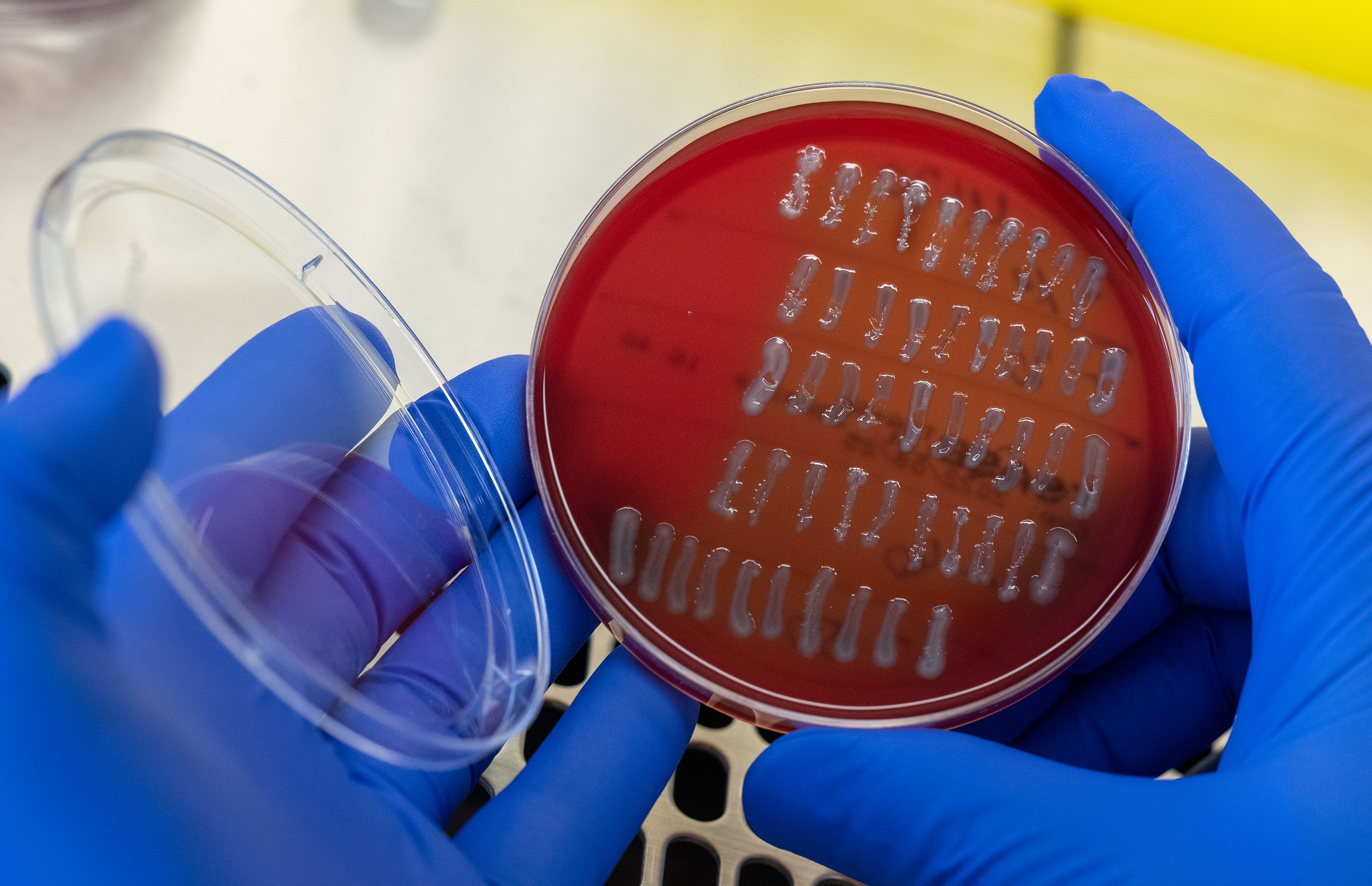 https://media.cnn.com/api/v1/images/stellar/prod/230629121922-02-escherichia-coli.jpg?c=original