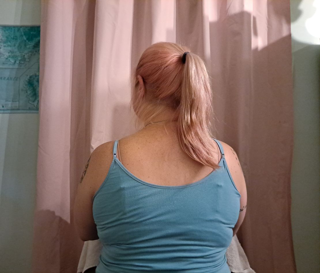 Victoria says getting the procedure gave her "a lot of self-confidence." She got through it and moved on.