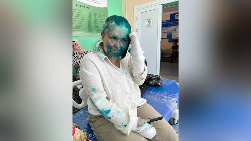 NextImg:Prominent Russian journalist 'severely beaten' in attack in Chechnya | CNN