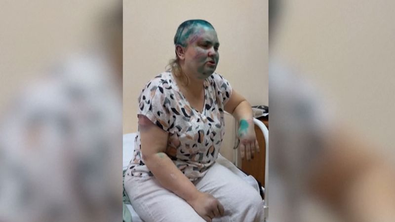 Russian journalist describes being beaten by masked assailants  | CNN