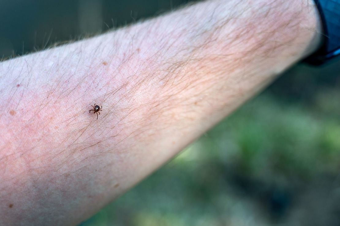 Be careful when removing a tick from your skin. Using tweezers, get the tick by its head as close to the skin as possible and pull it straight out.