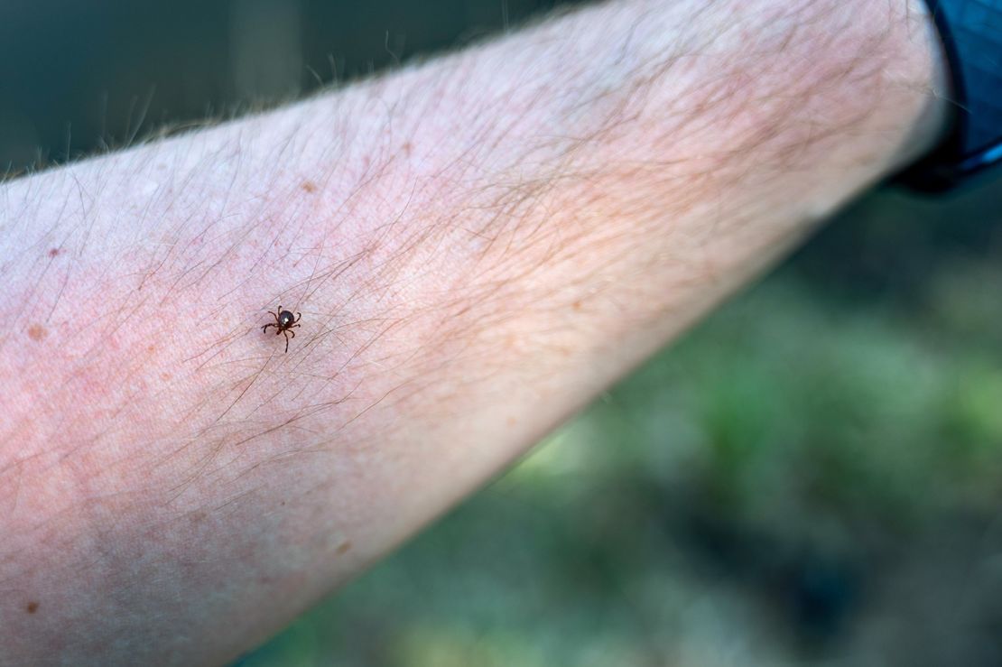 2F7XFTF A lone star tick, a common vector of diseases, crawling on an arm