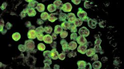 Материал Микрофотография, предоставена от Центъра за контрол и превенция на заболяванията (CDC), изобразява характеристиките, свързани със случай на първичен амебичен менингоенцефалит, рядка мозъчна инфекция, дължаща се на паразити Naegleria fowleri, амеба, разяждаща мозъка. 