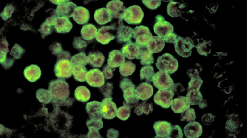 NextImg:2-year-old Nevada boy dies from brain-eating amoeba likely contracted at natural hot spring | CNN