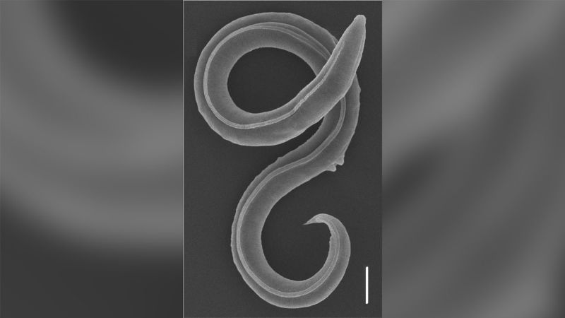 NextImg:A worm has been revived after 46,000 years in the Siberian permafrost | CNN
