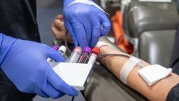 A nurse fills test tubes with blood to be tested during an American Red Cross bloodmobile in Fullerton, CA on Thursday, January 20, 2022.