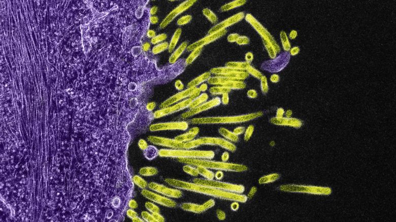Colorized transmission electron micrograph of SW31 (swine strain) influenza virus particles (green) attached to and budding from the surface of a MDCK cell (purple). Image captured and color-enhanced at the NIAID Integrated Research Facility in Fort Detrick, Maryland. Credit: NIAID.