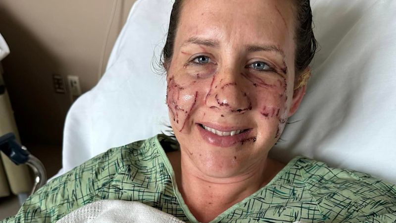 Woman attacked by ‘vicious’ otter: ‘I did not think I was going to make it out of that river’ | CNN