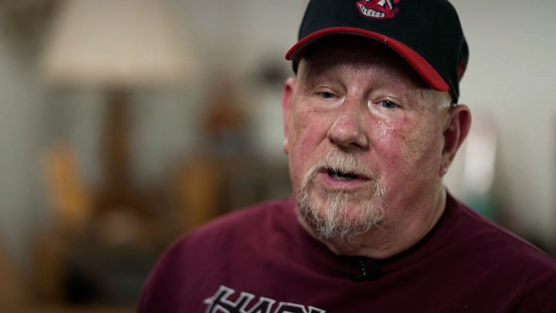 Video: Deep brain stimulation helps stroke survivor regain movement | CNN