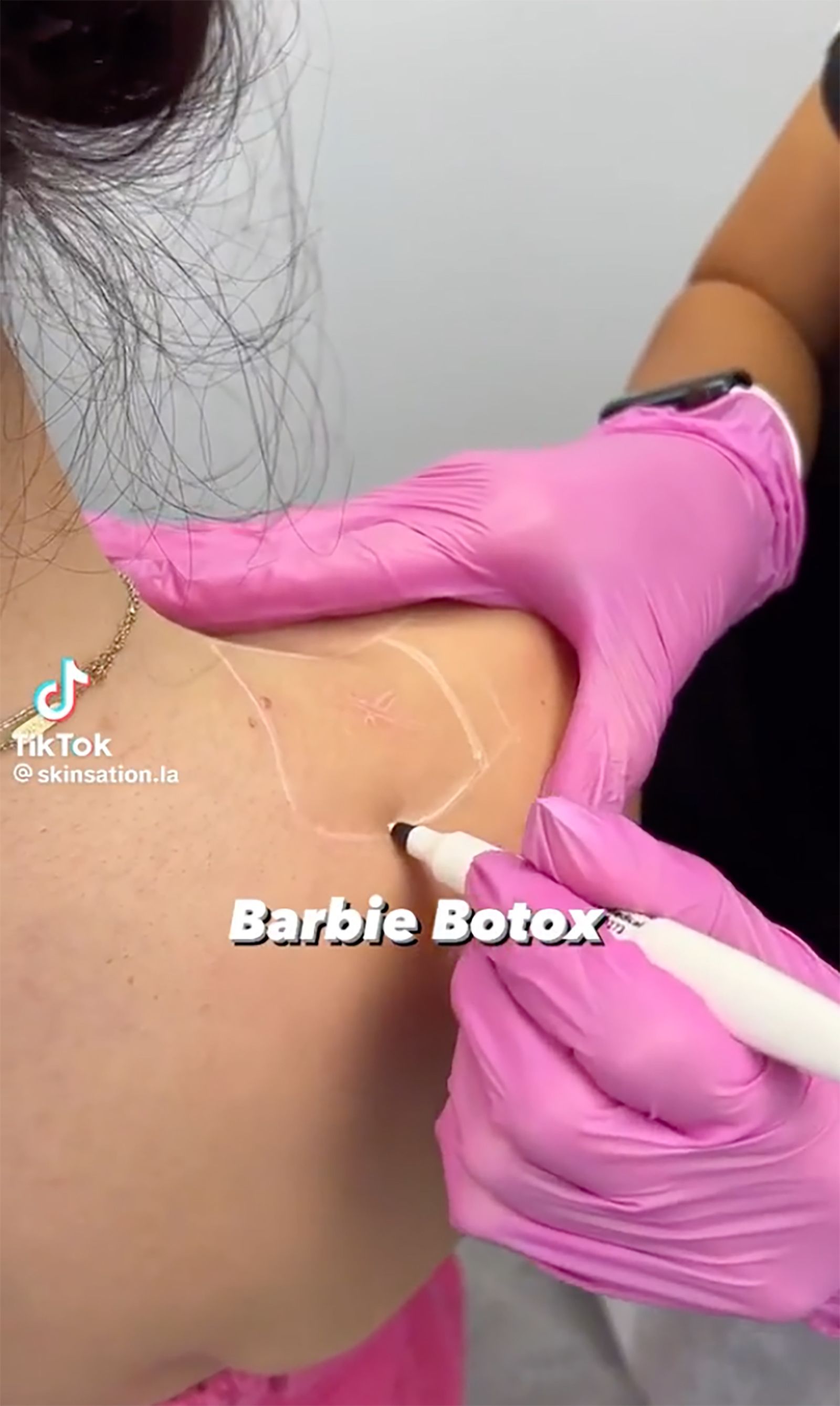 Botox Barbie