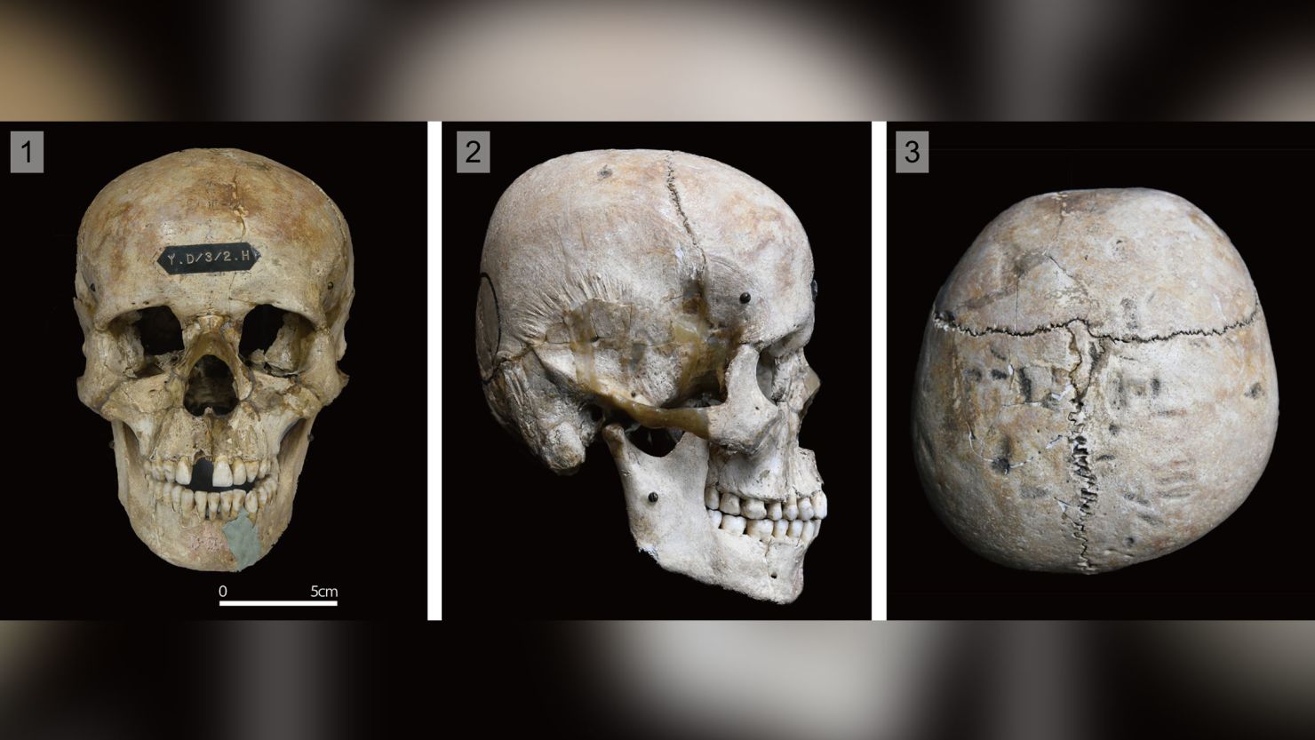The skull of individual "HT4" from the Hirota site on the island of Tanegashima in Japan is shown (from left) in frontal, right-lateral and superior views.