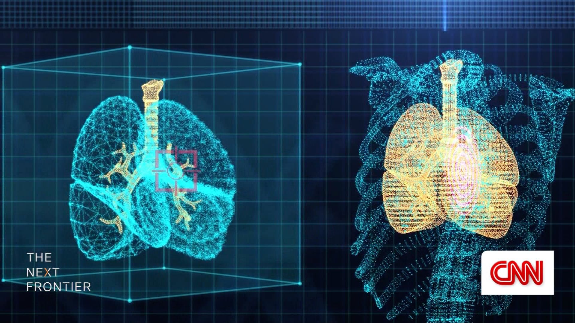 Frontiers  Digital Twins for Multiple Sclerosis