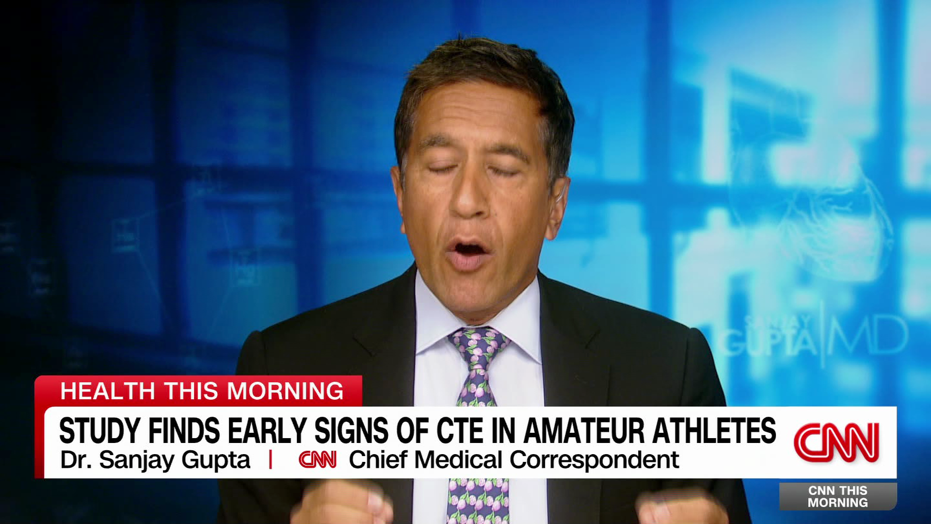 Study finds early signs of CTE in amateur athletes