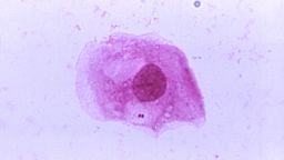 A photomicrograph shows Neisseria meningitidis bacteria.