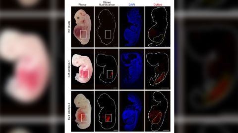 human kidneys in pig embryos first time
