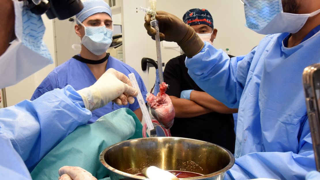 In this photo provided by the University of Maryland School of Medicine, surgeons prepare for a pig heart transplant into Lawrence Faucette at the school's hospital in Baltimore, Md., in September 2023.