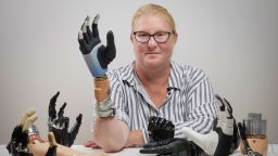 A highly integrated bionic hand in between many others
EMBARGOED UNTIL 2PM ET 10/11/23