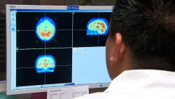 brain nap video